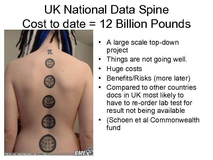 UK National Data Spine Cost to date = 12 Billion Pounds • A large