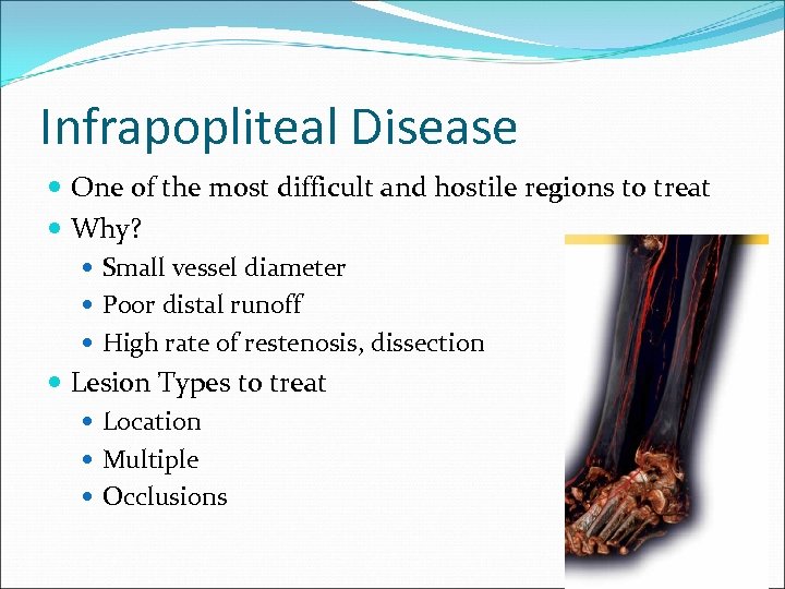 Infrapopliteal Disease One of the most difficult and hostile regions to treat Why? Small