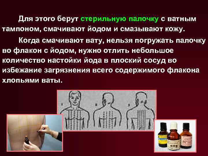 Для этого берут стерильную палочку с ватным тампоном, смачивают йодом и смазывают кожу. Когда