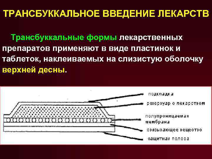 ТРАНСБУККАЛЬНОЕ ВВЕДЕНИЕ ЛЕКАРСТВ Трансбуккальные формы лекарственных препаратов применяют в виде пластинок и таблеток, наклеиваемых