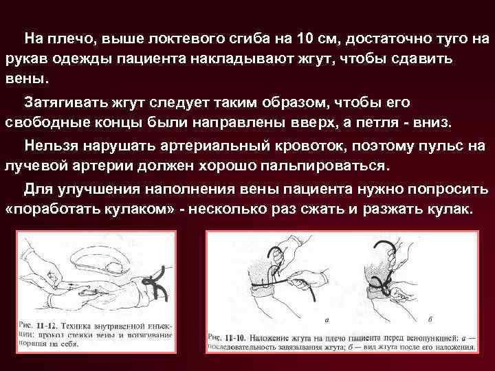 На плечо, выше локтевого сгиба на 10 см, достаточно туго на рукав одежды пациента