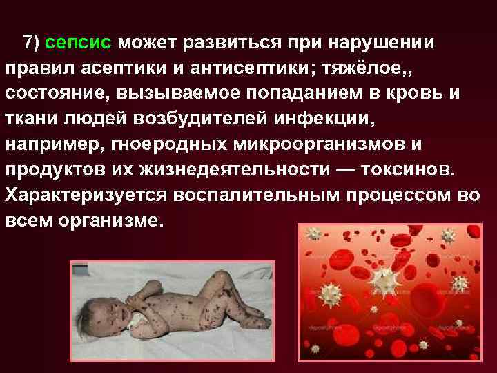 7) сепсис может развиться при нарушении правил асептики и антисептики; тяжёлое, , состояние, вызываемое