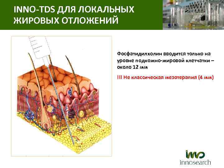 INNO-TDS ДЛЯ ЛОКАЛЬНЫХ ЖИРОВЫХ ОТЛОЖЕНИЙ Фосфатидилхолин вводится только на уровне подкожно-жировой клетчатки – около