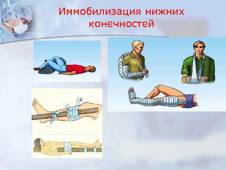 Иммобилизация нижних конечностей 