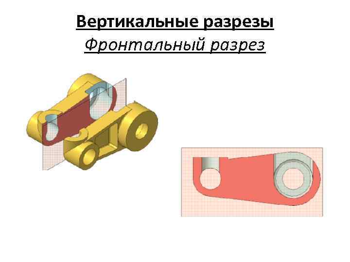 Веpтикальные pазpезы Фронтальный разрез 