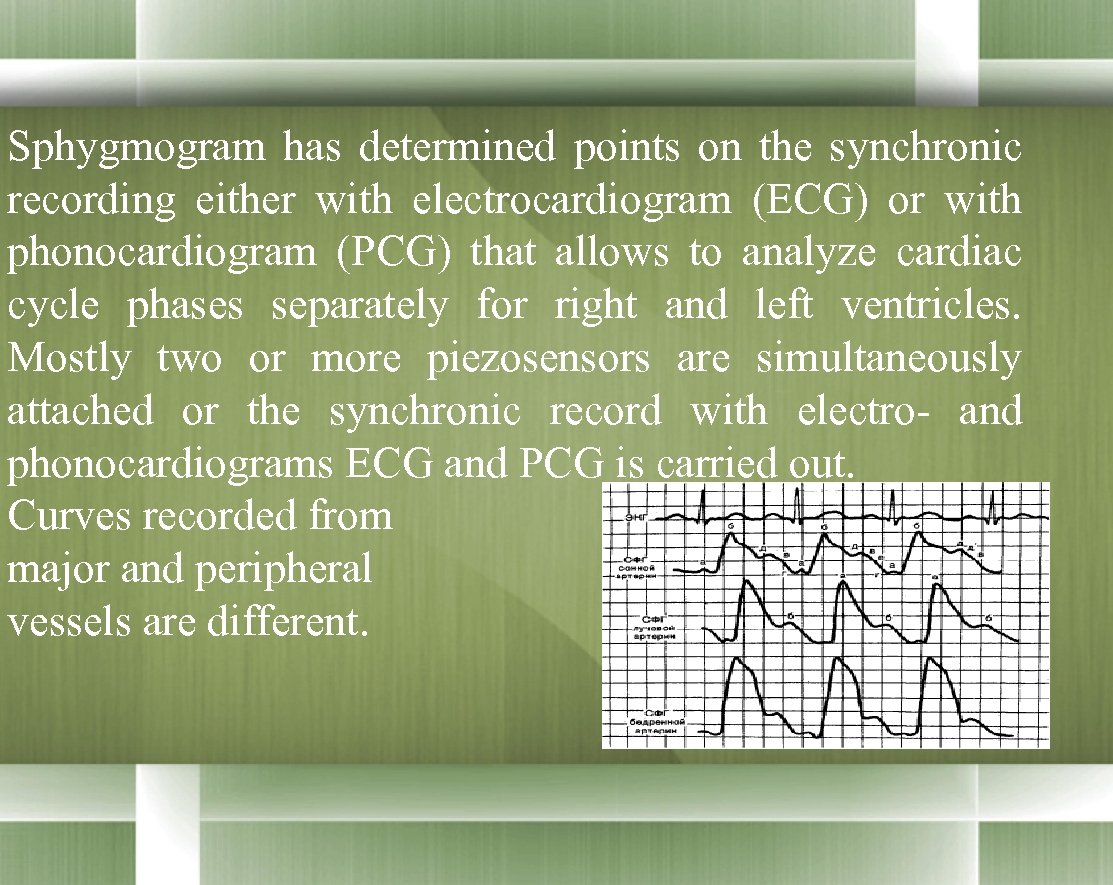 Sphygmogram has determined points on the synchronic recording either with electrocardiogram (ECG) or with