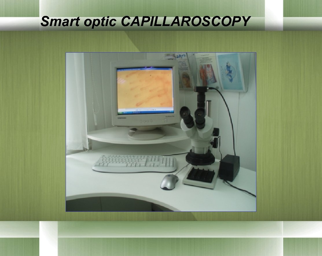 Smart optic CAPILLAROSCOPY 