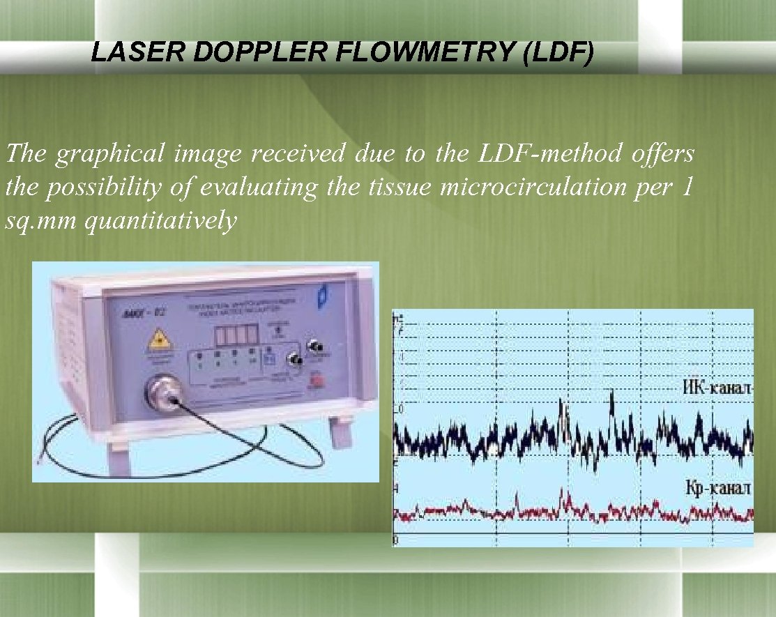  LASER DOPPLER FLOWMETRY (LDF) The graphical image received due to the LDF-method offers