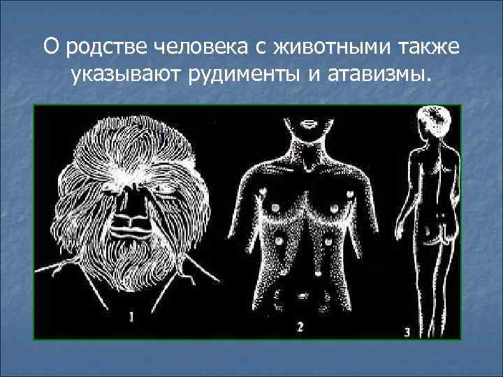 О родстве человека с животными также указывают рудименты и атавизмы. 