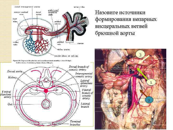 Назовите источники формирования непарных висцеральных ветвей брюшной аорты 3 1 2 