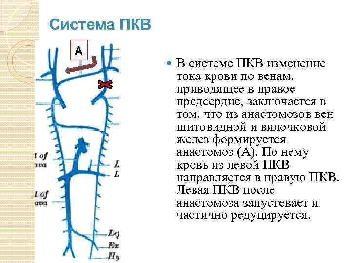 Система ПКВ А В системе ПКВ изменение тока крови по венам, приводящее в правое