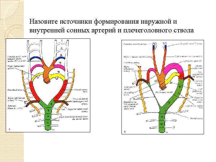 Уаз сонных артерий