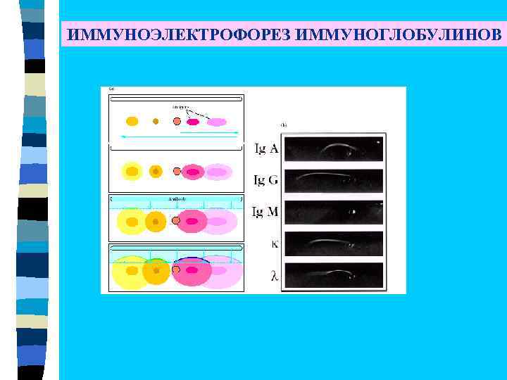 ИММУНОЭЛЕКТРОФОРЕЗ ИММУНОГЛОБУЛИНОВ 