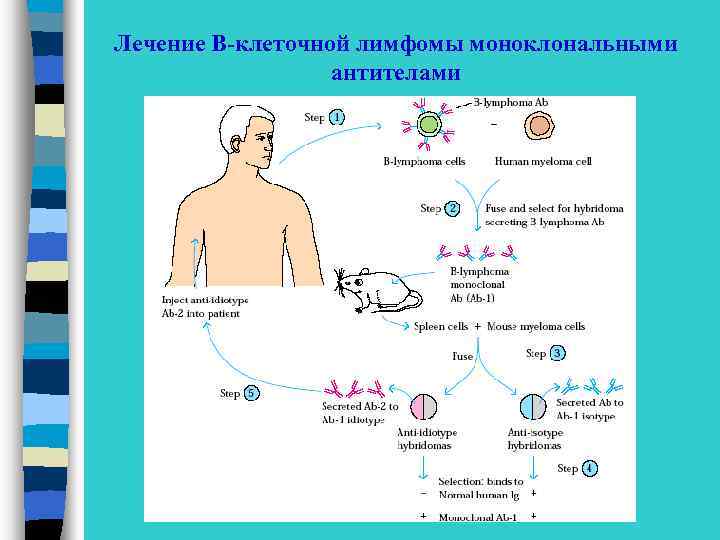 Лечение В-клеточной лимфомы моноклональными антителами 