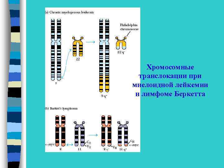 Хромосомные транслокации при миелоидной лейкемии и лимфоме Беркетта 