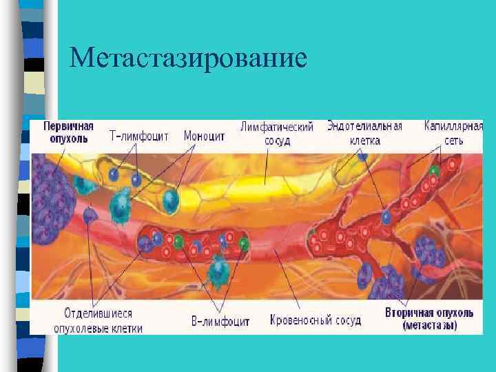 Метастазирование 