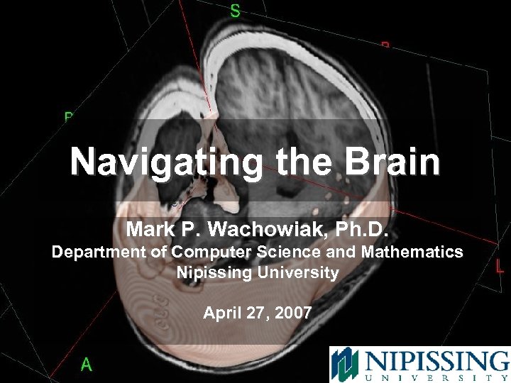 Navigating the Brain Mark P. Wachowiak, Ph. D. Department of Computer Science and Mathematics
