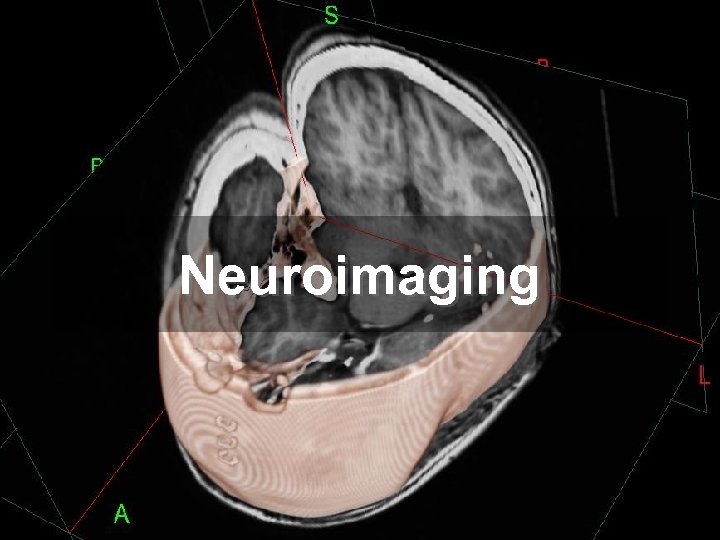 Neuroimaging 