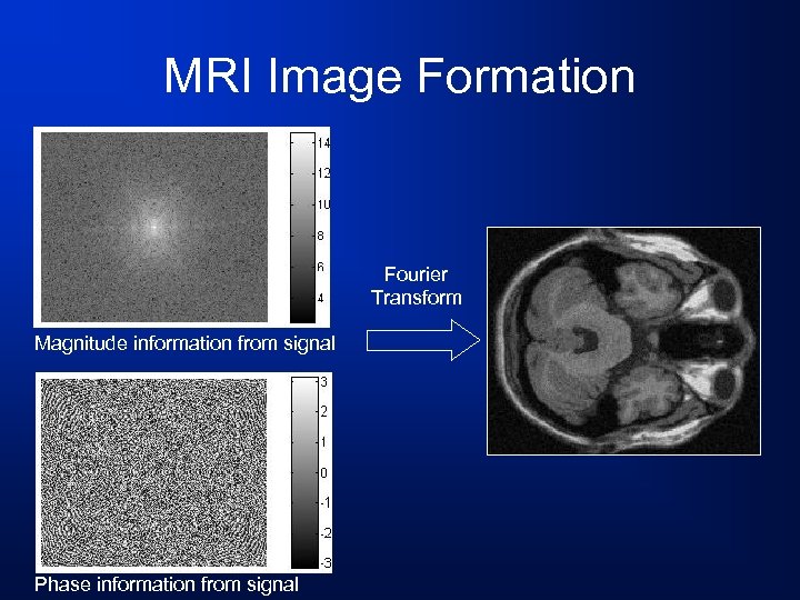MRI Image Formation Fourier Transform Magnitude information from signal Phase information from signal 