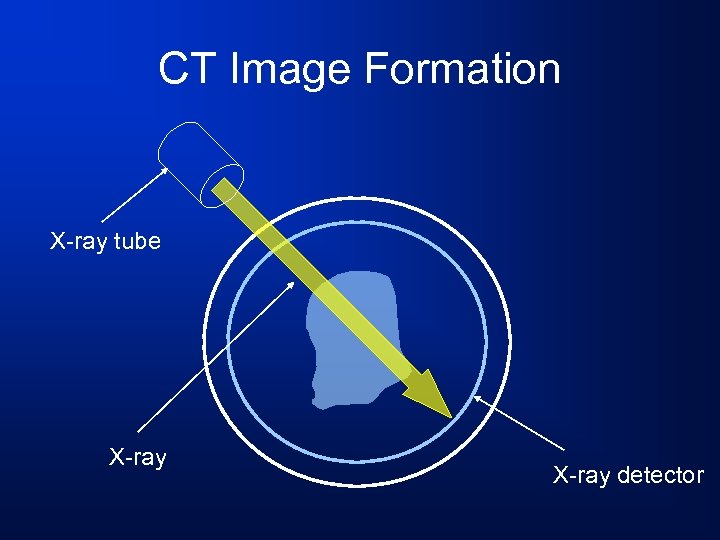 CT Image Formation X-ray tube X-ray detector 
