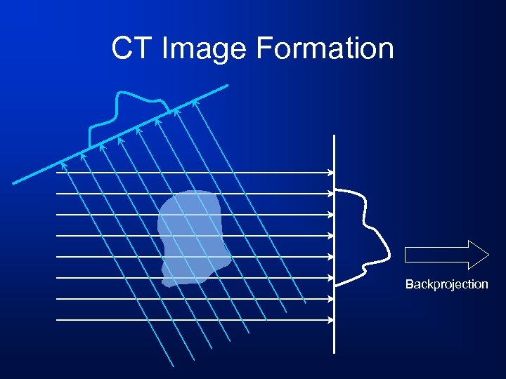 CT Image Formation Backprojection 