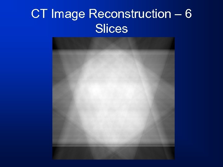 CT Image Reconstruction – 6 Slices 