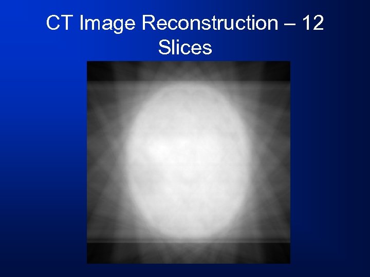 CT Image Reconstruction – 12 Slices 