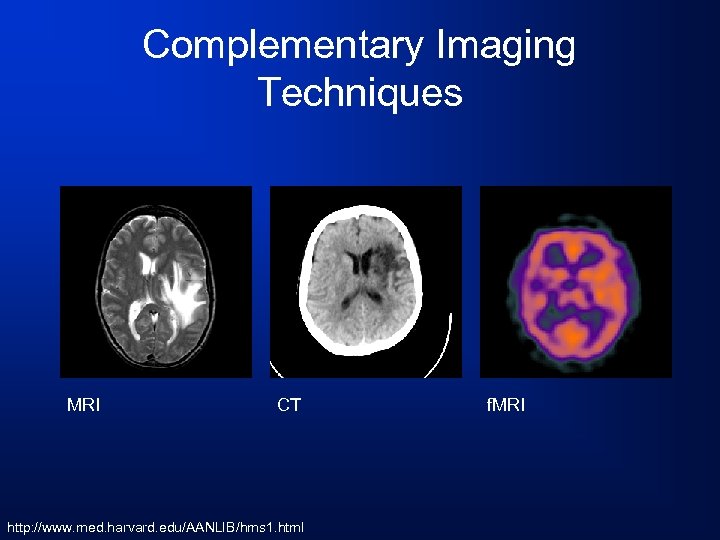 Complementary Imaging Techniques MRI CT http: //www. med. harvard. edu/AANLIB/hms 1. html f. MRI