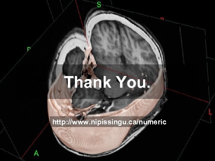 Thank You. http: //www. nipissingu. ca/numeric 