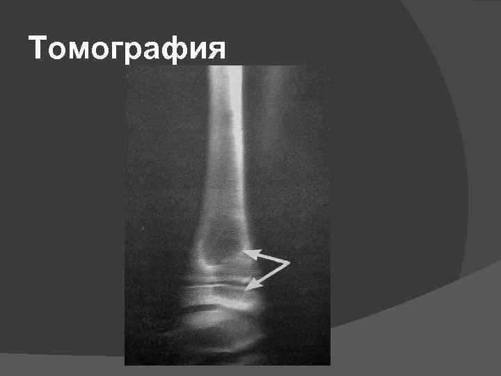 Томография 