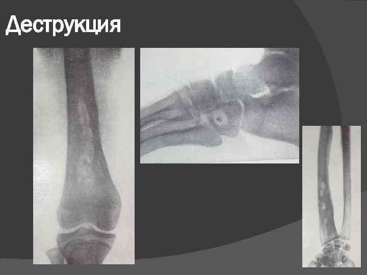 Деструкция 