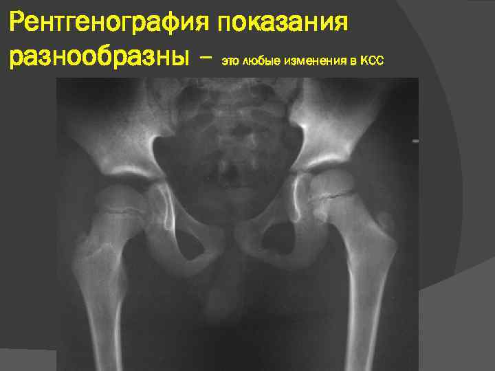 Рентгенография показания разнообразны – это любые изменения в КСС 