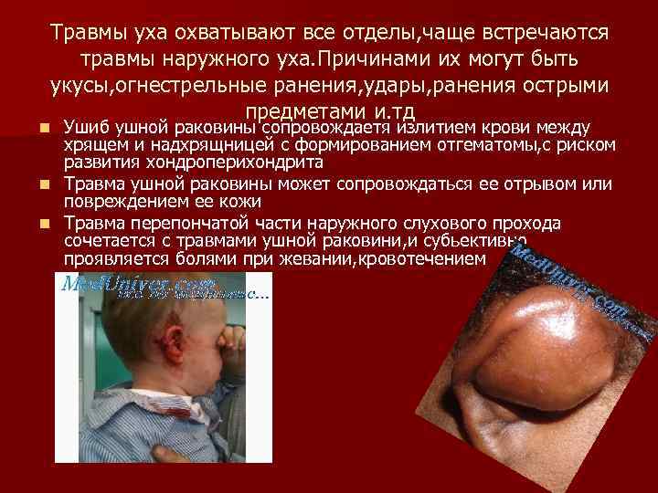 Травмы уха охватывают все отделы, чаще встречаются травмы наружного уха. Причинами их могут быть