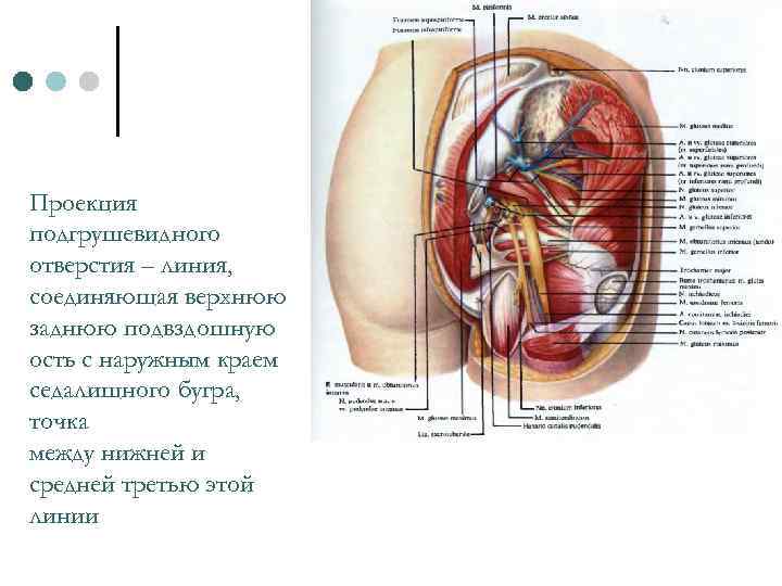 Проекция подгрушевидного отверстия – линия, соединяющая верхнюю заднюю подвздошную ость с наружным краем седалищного