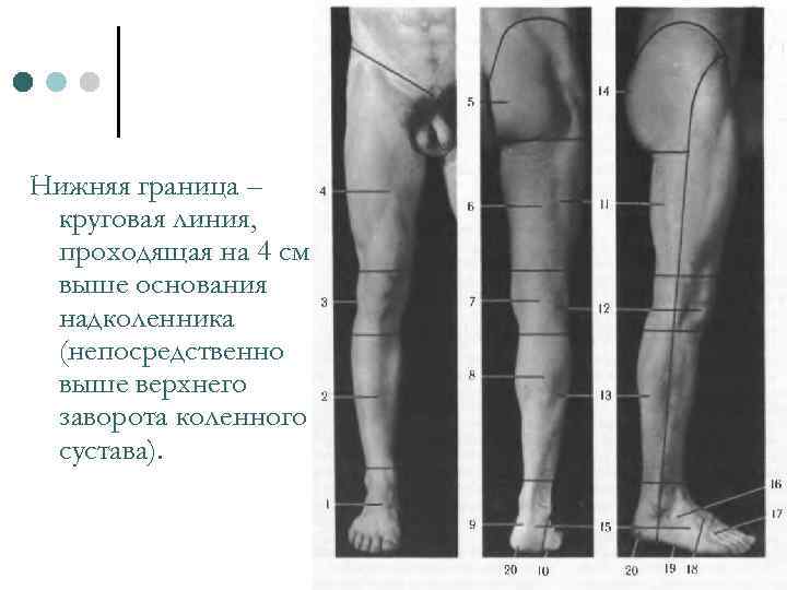 Нижняя граница – круговая линия, проходящая на 4 см выше основания надколенника (непосредственно выше