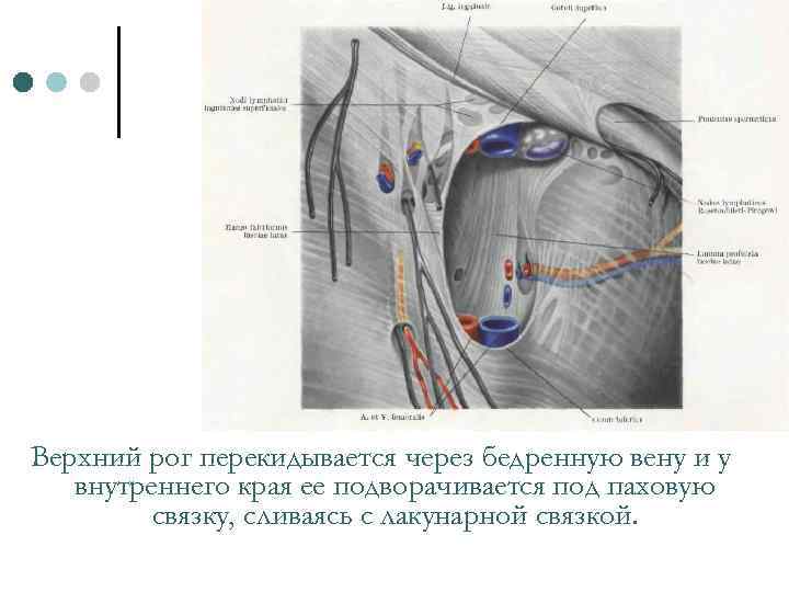 Верхний рог перекидывается через бедренную вену и у внутреннего края ее подворачивается под паховую