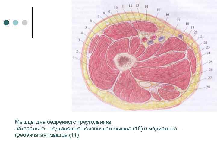 Мышцы дна бедренного треугольника: латерально - подвздошно-поясничная мышца (10) и медиально – гребенчатая мышца