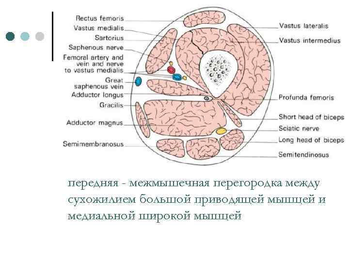 передняя - межмышечная перегородка между сухожилием большой приводящей мышцей и медиальной широкой мышцей 