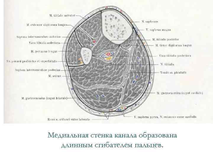 Медиальная стенка канала образована длинным сгибателем пальцев. 