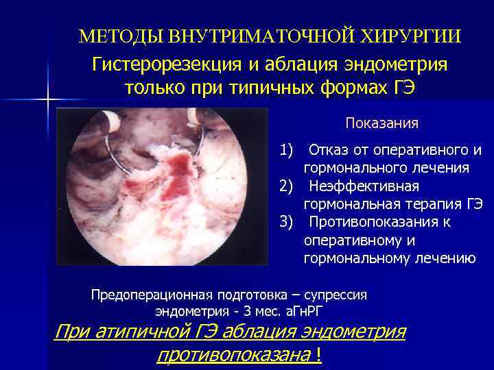 МЕТОДЫ ВНУТРИМАТОЧНОЙ ХИРУРГИИ Гистерорезекция и аблация эндометрия только при типичных формах ГЭ Показания 1)