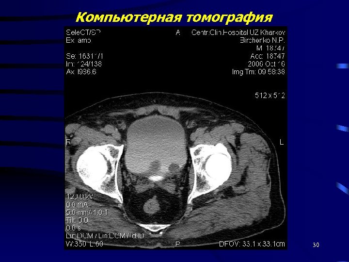 Компьютерная томография 30 