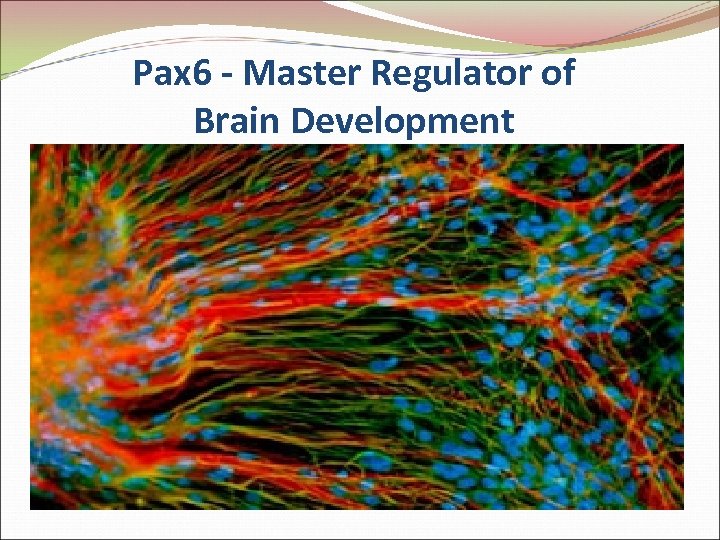 Pax 6 - Master Regulator of Brain Development 