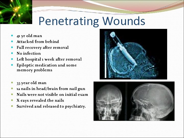 Penetrating Wounds 41 yr old man Attacked from behind Full recovery after removal No