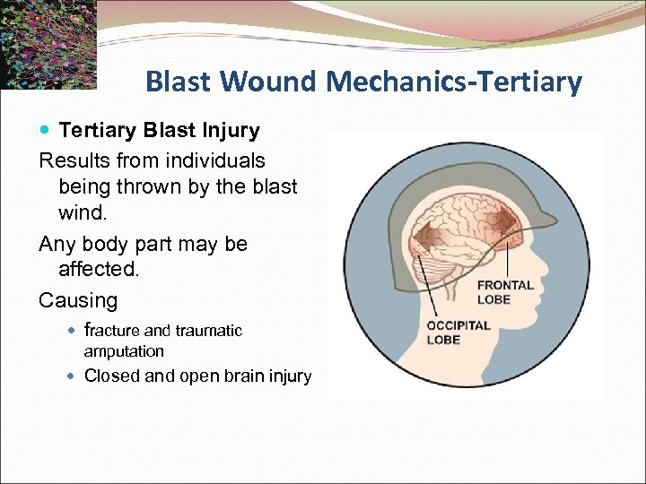 Blast Wound Mechanics-Tertiary Blast Injury Results from individuals being thrown by the blast wind.