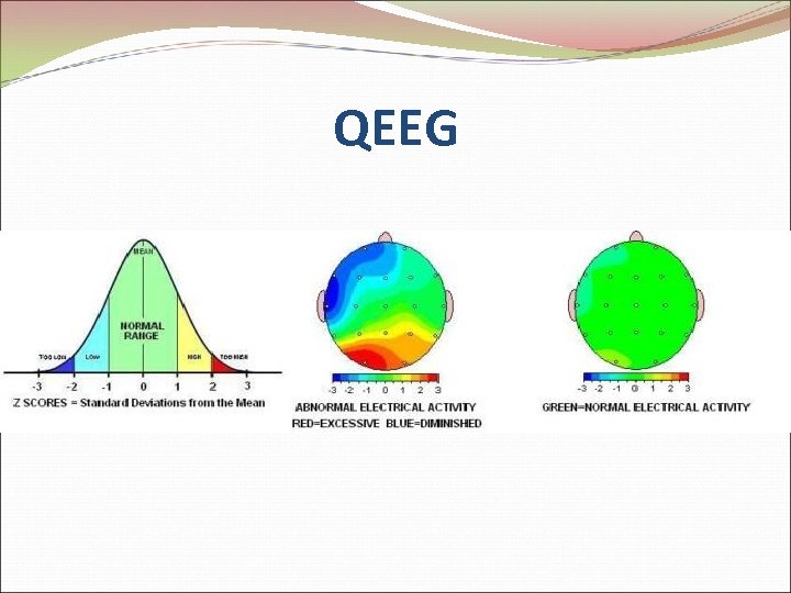 QEEG 