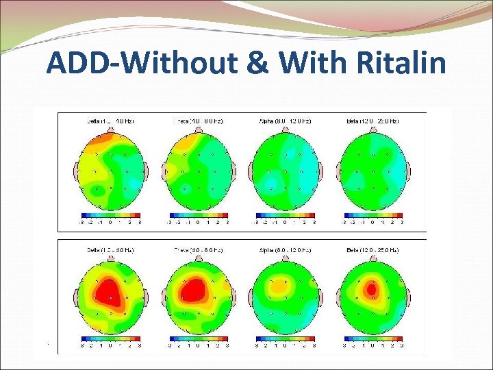 ADD-Without & With Ritalin 