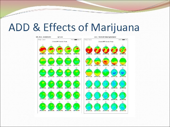 ADD & Effects of Marijuana 