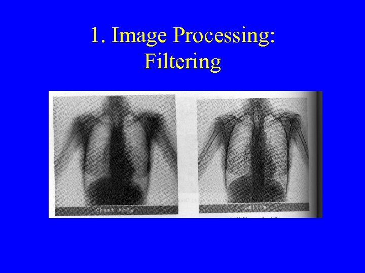 1. Image Processing: Filtering 