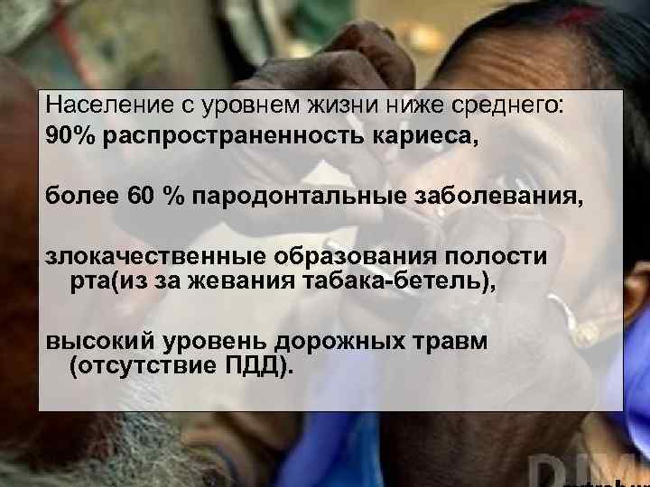 Население с уровнем жизни ниже среднего: 90% распространенность кариеса, более 60 % пародонтальные заболевания,