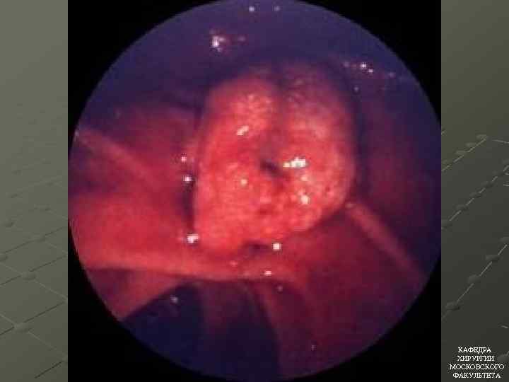 КАФЕДРА ХИРУРГИИ МОСКОВСКОГО ФАКУЛЬТЕТА 